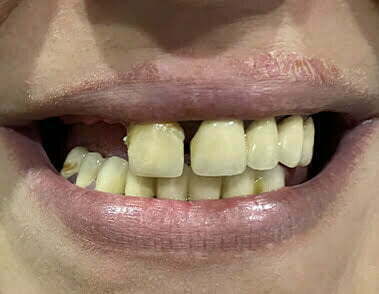 Before image