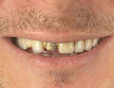 Before image
