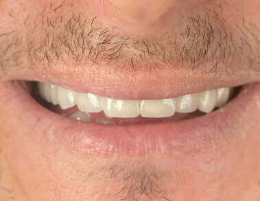 After image