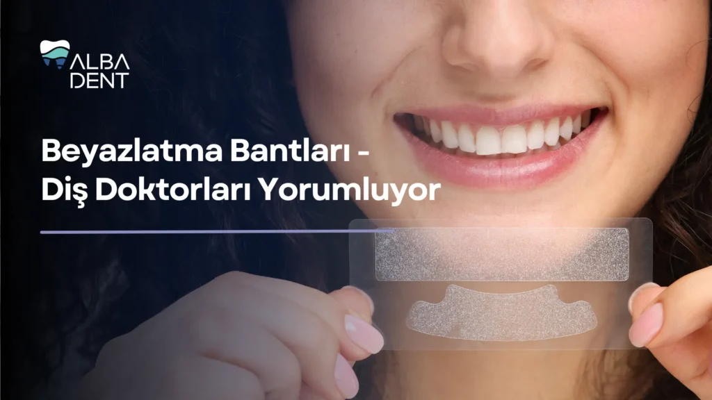  Beyazlatma Bantları